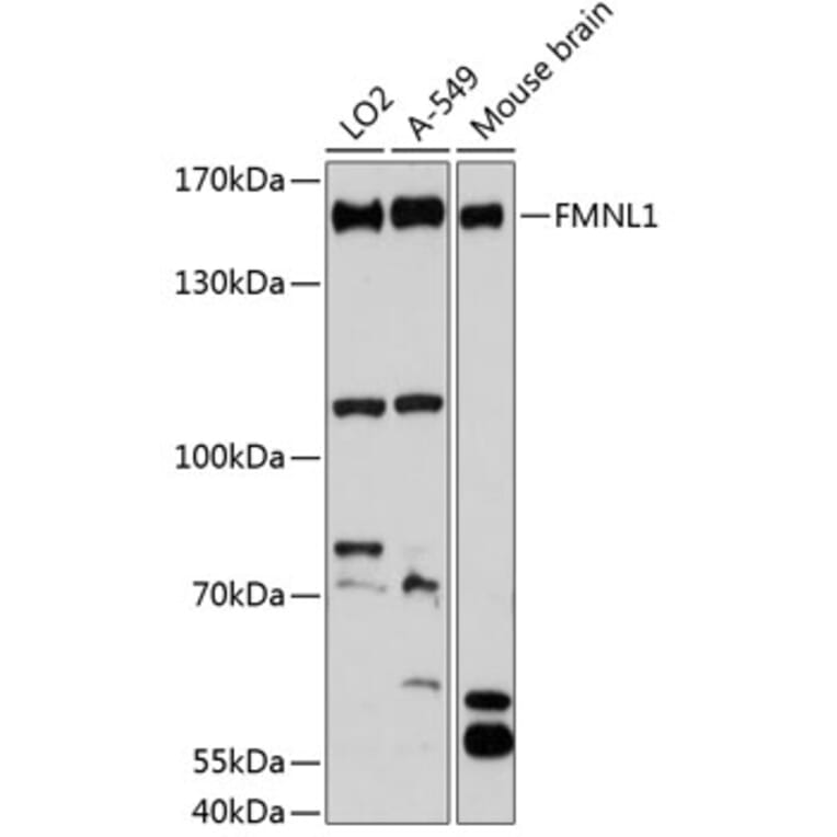 Western Blot - Anti-FMNL1 Antibody (A88351) - Antibodies.com