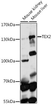Western blot analysis of extracts of various cell lines, using Anti-TEX2 Antibody (A14686) at 1:1,000 dilution.
Secondary antibody: Goat Anti-Rabbit IgG (H+L) (HRP) (AS014) at 1:10,000 dilution.
Lysates / proteins: 25µg per lane.
Blocking buffer: 3% non-fat dry milk in TBST.
Detection: ECL Basic Kit (RM00020).
Exposure time: 90s.