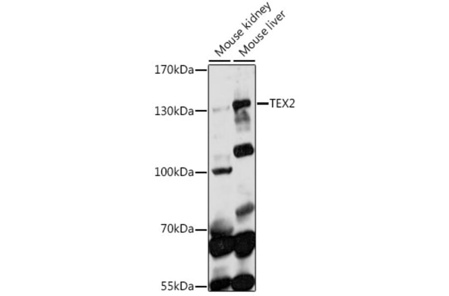 Western Blot - Anti-TEX2 Antibody (A88352) - Antibodies.com