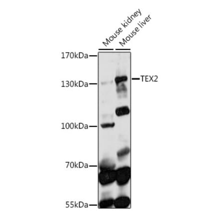 Western Blot - Anti-TEX2 Antibody (A88352) - Antibodies.com