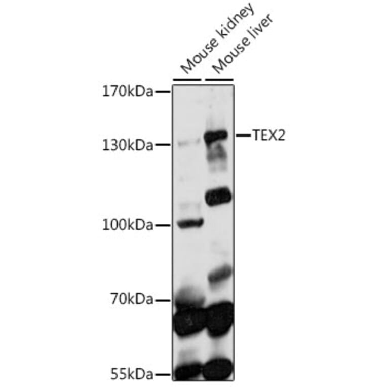 Western Blot - Anti-TEX2 Antibody (A88352) - Antibodies.com