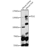 Western Blot - Anti-TEX2 Antibody (A88352) - Antibodies.com