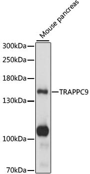 Western blot analysis of extracts of mouse pancreas, using Anti-TRAPPC9 Antibody (A15527) at 1:1,000 dilution.
Secondary antibody: Goat Anti-Rabbit IgG (H+L) (HRP) (AS014) at 1:10,000 dilution.
Lysates / proteins: 25µg per lane.
Blocking buffer: 3% non-fat dry milk in TBST.
Detection: ECL Basic Kit (RM00020).
Exposure time: 1s.