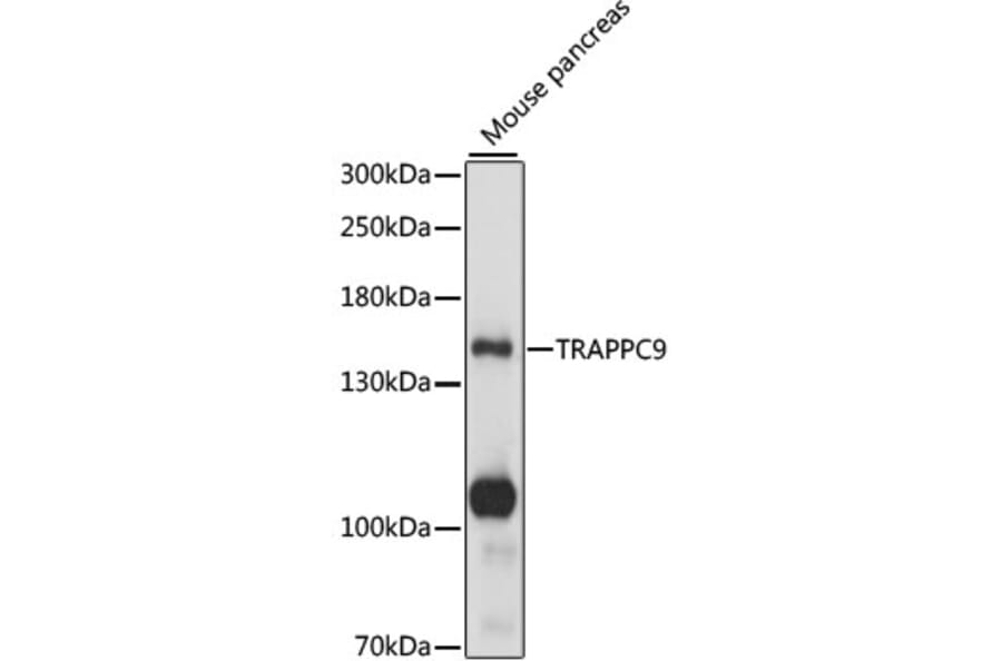 Western Blot - Anti-TRAPPC9 Antibody (A88353) - Antibodies.com