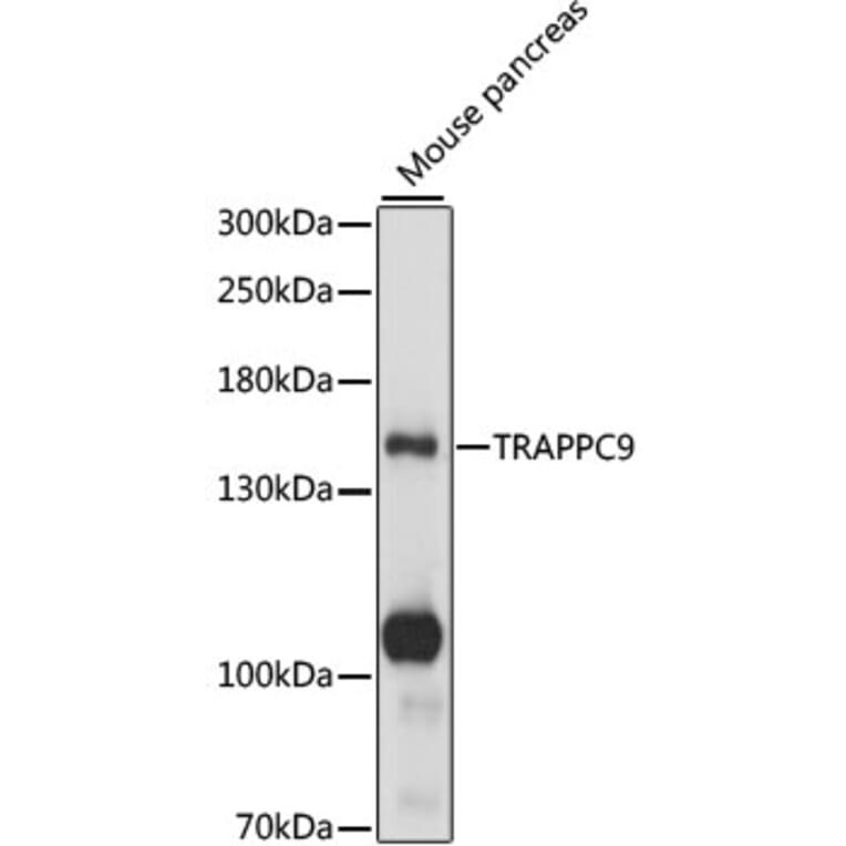 Western Blot - Anti-TRAPPC9 Antibody (A88353) - Antibodies.com