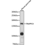 Western Blot - Anti-TRAPPC9 Antibody (A88353) - Antibodies.com