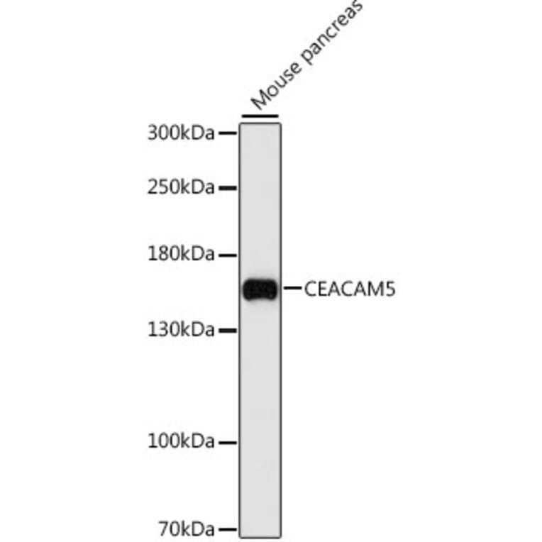 Western Blot - Anti-CEACAM5 Antibody (A88354) - Antibodies.com