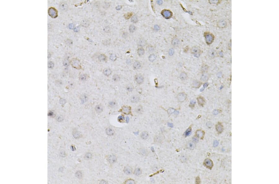 Immunohistochemistry - Anti-CEACAM5 Antibody (A88354) - Antibodies.com