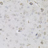 Immunohistochemistry - Anti-CEACAM5 Antibody (A88354) - Antibodies.com