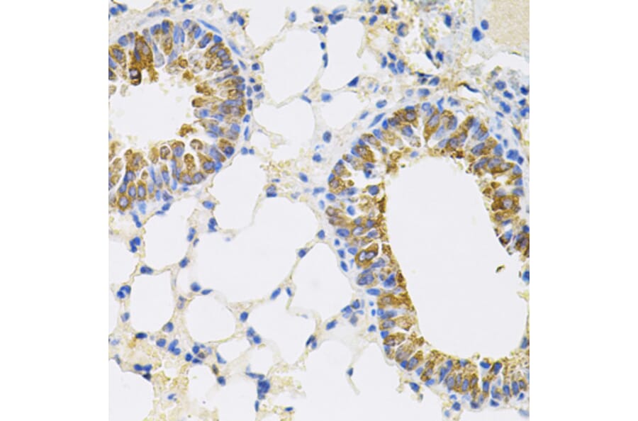 Immunohistochemistry - Anti-CEACAM5 Antibody (A88354) - Antibodies.com