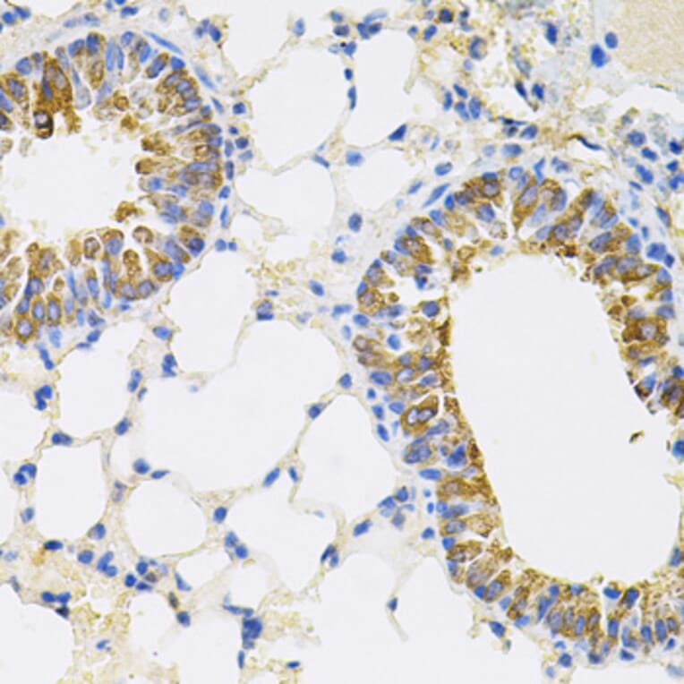 Immunohistochemistry - Anti-CEACAM5 Antibody (A88354) - Antibodies.com