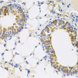 Immunohistochemistry - Anti-CEACAM5 Antibody (A88354) - Antibodies.com
