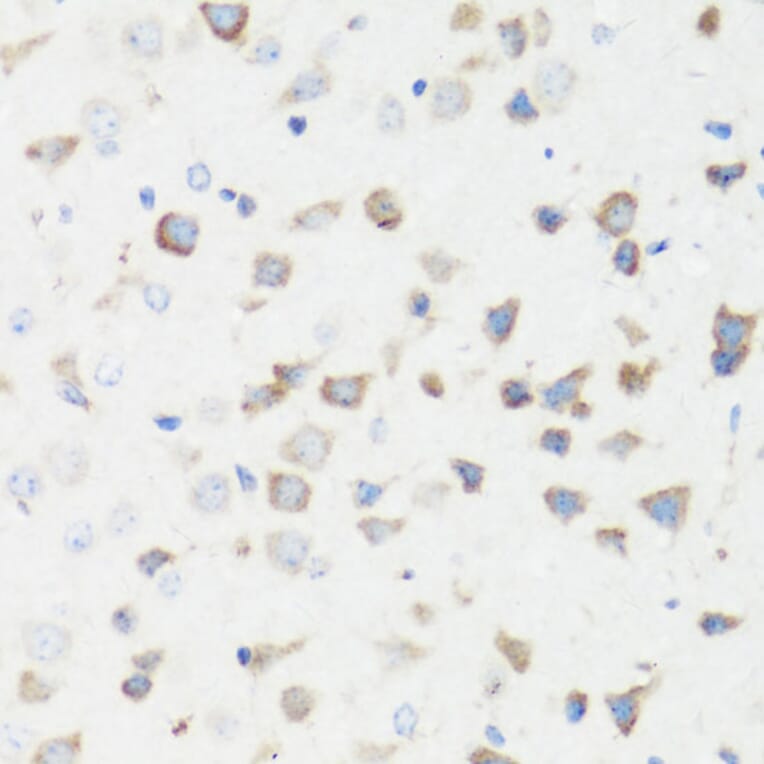 Immunohistochemistry - Anti-GM130 Antibody (A88355) - Antibodies.com