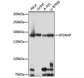 Western Blot - Anti-SFRS8 Antibody (A88356) - Antibodies.com
