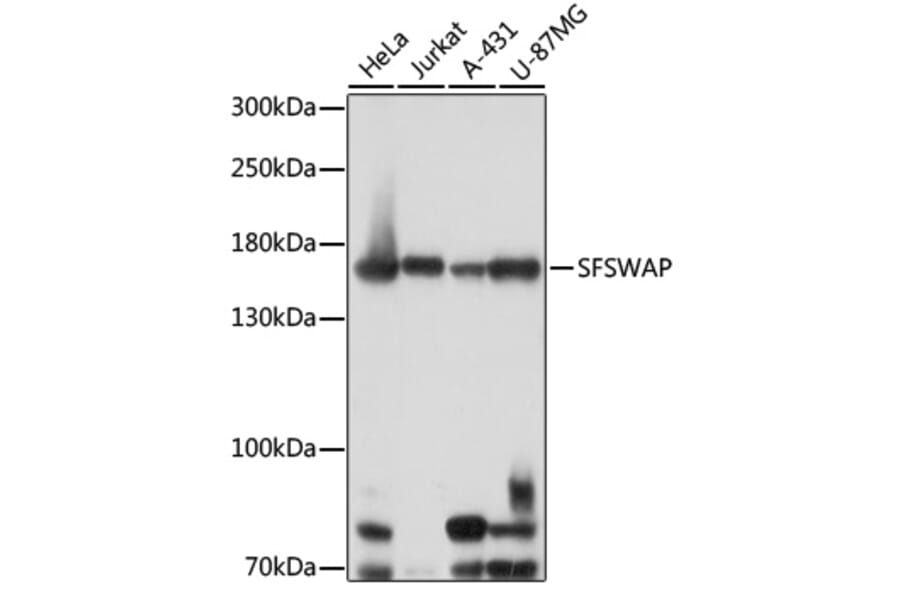 Western Blot - Anti-SFRS8 Antibody (A88356) - Antibodies.com
