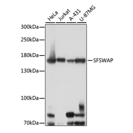 Western Blot - Anti-SFRS8 Antibody (A88356) - Antibodies.com