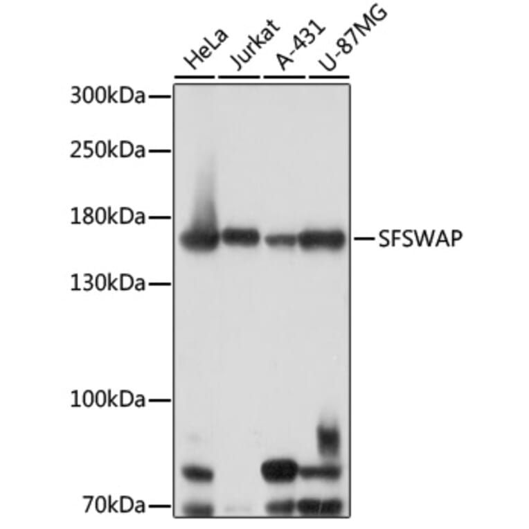Western Blot - Anti-SFRS8 Antibody (A88356) - Antibodies.com
