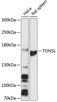Western blot analysis of extracts of various cell lines, using Anti-TONSL Antibody (A13035) at 1:3000 dilution.
Secondary antibody: Goat Anti-Rabbit IgG (H+L) (HRP) (AS014) at 1:10,000 dilution.
Lysates / proteins: 25µg per lane.
Blocking buffer: 3% non-fat dry milk in TBST.
Detection: ECL Basic Kit (RM00020).
Exposure time: 30s.