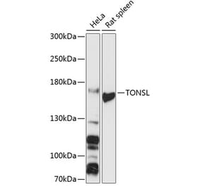 Western Blot - Anti-NFKBIL2 Antibody (A88357) - Antibodies.com
