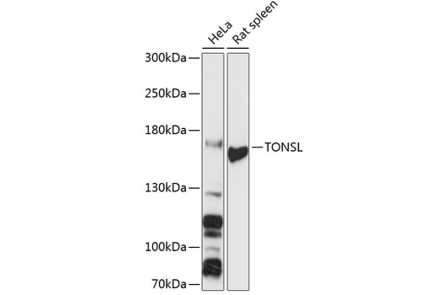 Western Blot - Anti-NFKBIL2 Antibody (A88357) - Antibodies.com