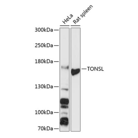 Western Blot - Anti-NFKBIL2 Antibody (A88357) - Antibodies.com