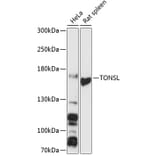 Western Blot - Anti-NFKBIL2 Antibody (A88357) - Antibodies.com