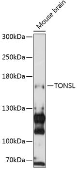 Western blot analysis of extracts of mouse brain, using Anti-TONSL Antibody (A13035) at 1:3000 dilution.
Secondary antibody: Goat Anti-Rabbit IgG (H+L) (HRP) (AS014) at 1:10,000 dilution.
Lysates / proteins: 25µg per lane.
Blocking buffer: 3% non-fat dry milk in TBST.
Detection: ECL Basic Kit (RM00020).
Exposure time: 90s.