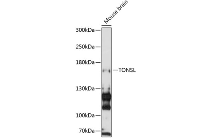 Western Blot - Anti-NFKBIL2 Antibody (A88357) - Antibodies.com