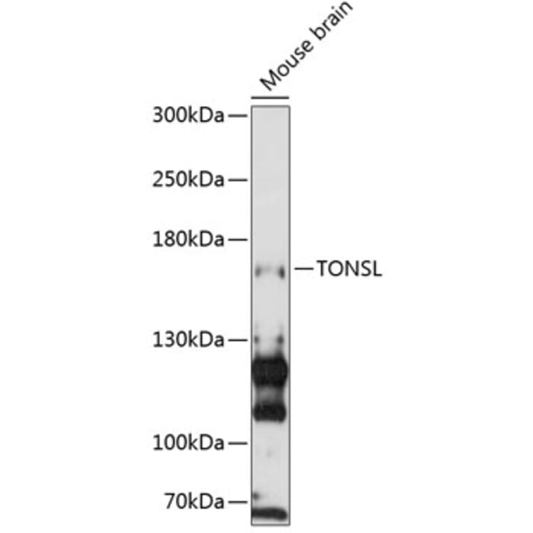 Western Blot - Anti-NFKBIL2 Antibody (A88357) - Antibodies.com