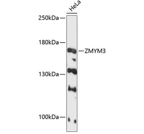 Western Blot - Anti-ZMYM3 Antibody (A88358) - Antibodies.com