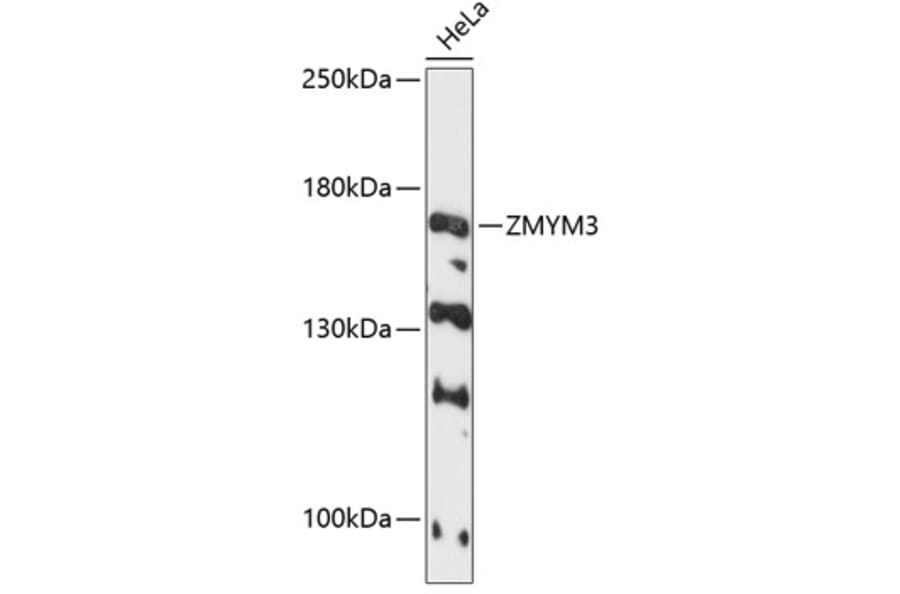 Western Blot - Anti-ZMYM3 Antibody (A88358) - Antibodies.com
