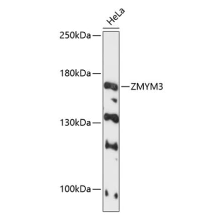 Western Blot - Anti-ZMYM3 Antibody (A88358) - Antibodies.com
