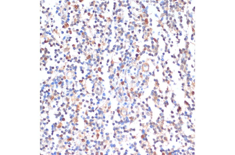 Immunohistochemistry - Anti-ZMYM3 Antibody (A88358) - Antibodies.com