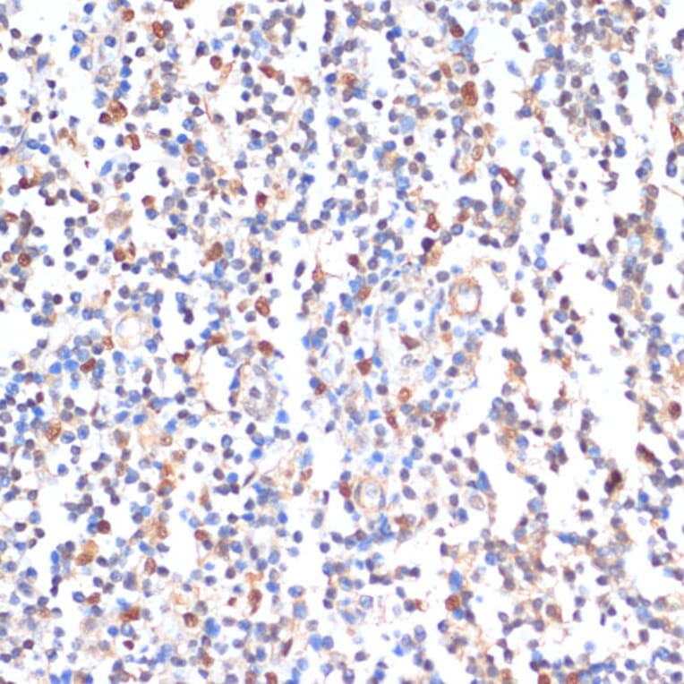 Immunohistochemistry - Anti-ZMYM3 Antibody (A88358) - Antibodies.com