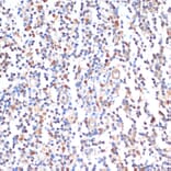 Immunohistochemistry - Anti-ZMYM3 Antibody (A88358) - Antibodies.com