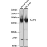 Western Blot - Anti-CAPS1 Antibody (A88359) - Antibodies.com