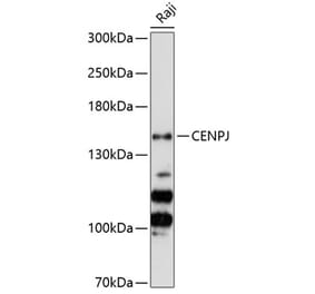 Western Blot - Anti-CENPJ Antibody (A88360) - Antibodies.com