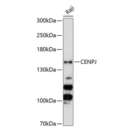 Western Blot - Anti-CENPJ Antibody (A88360) - Antibodies.com