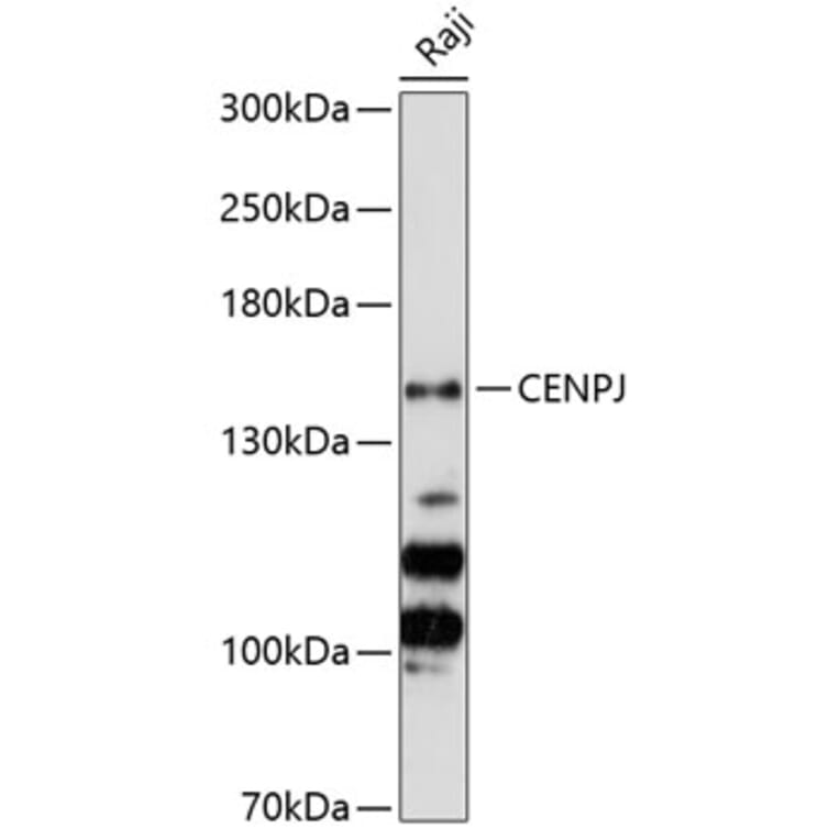 Western Blot - Anti-CENPJ Antibody (A88360) - Antibodies.com