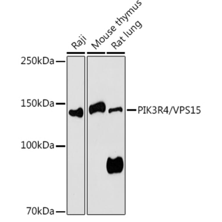 Western Blot - Anti-VPS15 Antibody (A88361) - Antibodies.com