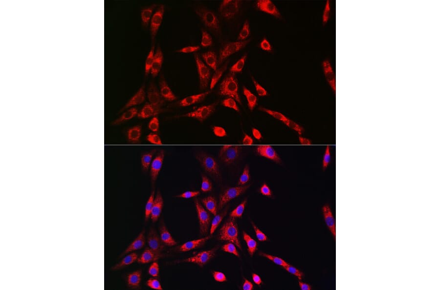 Immunofluorescence - Anti-VPS15 Antibody (A88361) - Antibodies.com