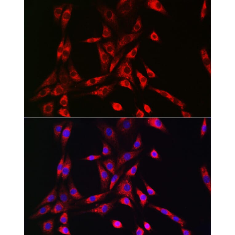 Immunofluorescence - Anti-VPS15 Antibody (A88361) - Antibodies.com