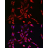 Immunofluorescence - Anti-VPS15 Antibody (A88361) - Antibodies.com
