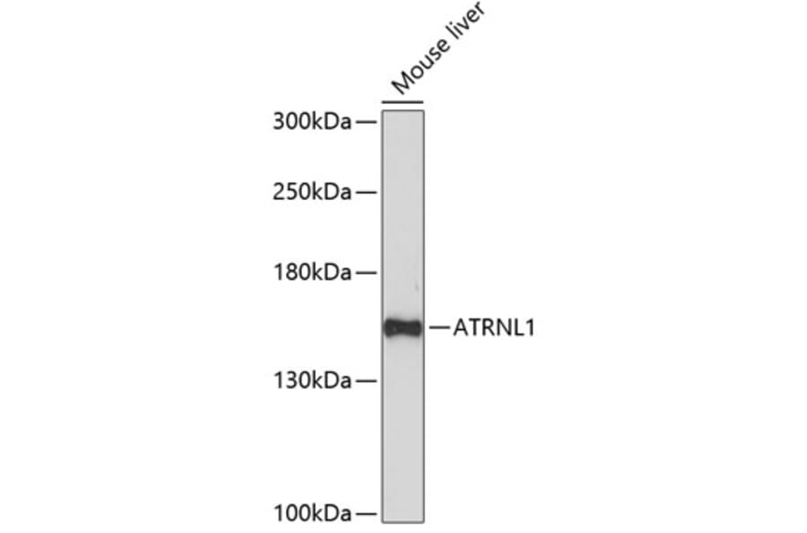 Western Blot - Anti-ATRNL1 Antibody (A88362) - Antibodies.com