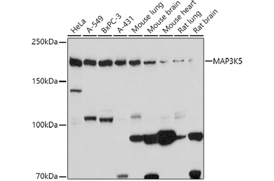 Western Blot - Anti-ASK1 Antibody (A88363) - Antibodies.com