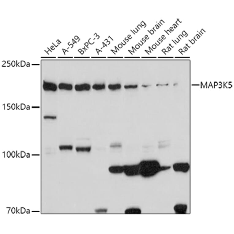Western Blot - Anti-ASK1 Antibody (A88363) - Antibodies.com