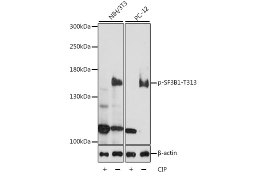 Western Blot - Anti-SF3B1 (phospho Thr313) Antibody (A88365) - Antibodies.com
