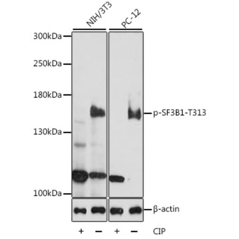 Western Blot - Anti-SF3B1 (phospho Thr313) Antibody (A88365) - Antibodies.com