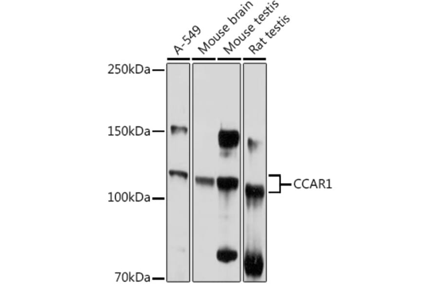 Western Blot - Anti-DIS Antibody (A88366) - Antibodies.com