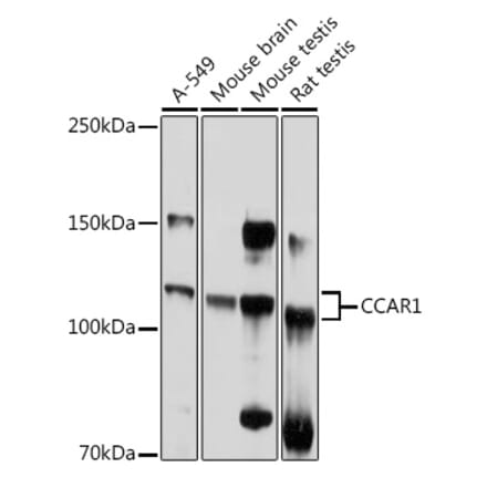 Western Blot - Anti-DIS Antibody (A88366) - Antibodies.com